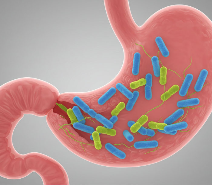 ピロリ菌について